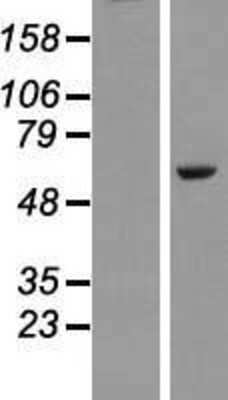 Western Blot: PLAG1 Overexpression Lysate [NBL1-14483]