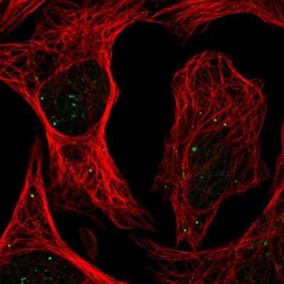 Immunocytochemistry/ Immunofluorescence: PLAGL1 Antibody [NBP2-56498]