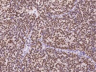 Immunohistochemistry-Paraffin: PLAGL1 Antibody [NBP3-06208]