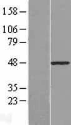 Western Blot: PLAGL1 Overexpression Lysate [NBP2-08412]