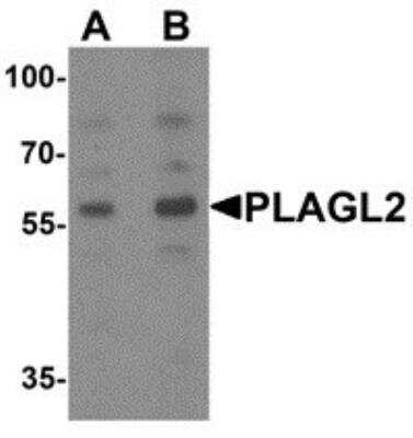 Western Blot: PLAGL2 AntibodyBSA Free [NBP2-81930]