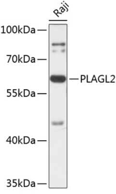 Western Blot: PLAGL2 AntibodyAzide and BSA Free [NBP2-93241]