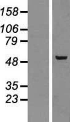 Western Blot: PLAGL2 Overexpression Lysate [NBP2-08085]