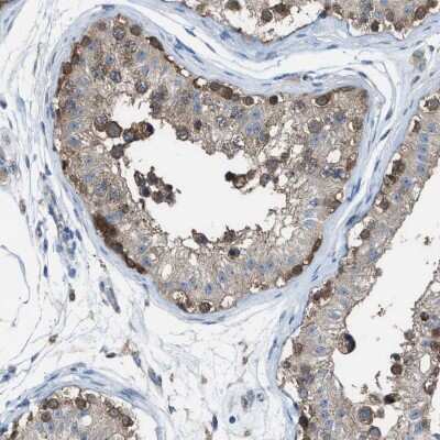 Immunohistochemistry-Paraffin: PLAP Antibody [NBP1-84996]