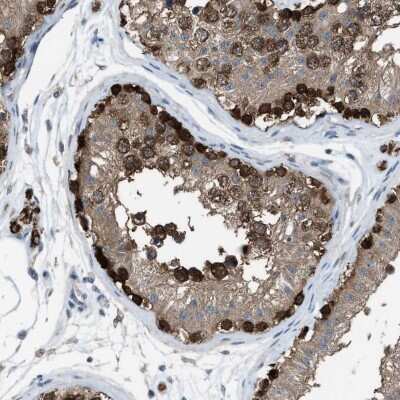 Immunohistochemistry-Paraffin: PLAP Antibody [NBP1-84997]