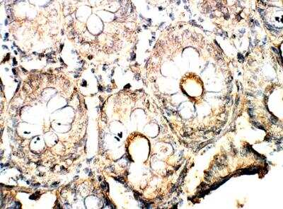 Immunohistochemistry-Paraffin: PLAP Antibody [NBP3-12333]