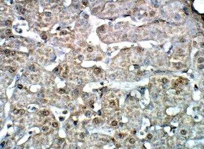 Immunohistochemistry-Paraffin: PLAP Antibody [NBP3-12333]