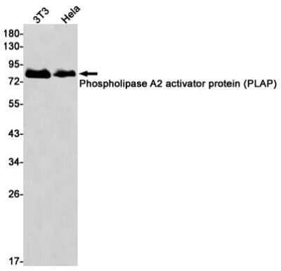 Western Blot: PLAP Antibody (S06-1D7) [NBP3-15078]