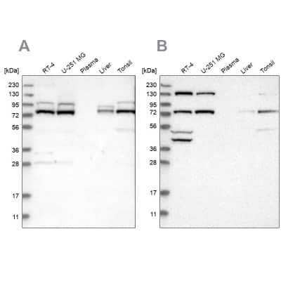 Western Blot: PLAP Antibody [NBP1-84996]