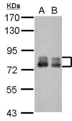 Western Blot: PLAP Antibody [NBP2-19858]