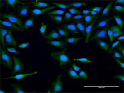 Immunocytochemistry/ Immunofluorescence: PLBD1 Antibody [H00079887-D01P]
