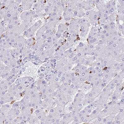 Immunohistochemistry-Paraffin: PLBD1 Antibody [NBP2-37893]