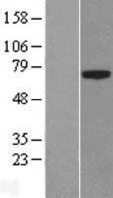 Western Blot: PLBD1 Overexpression Lysate [NBL1-10759]