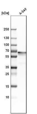 Western Blot: PLBD2 Antibody [NBP1-90681]