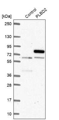 Western Blot: PLBD2 Antibody [NBP1-90681]