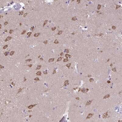 Immunohistochemistry: PLC-beta 1 Antibody [NBP2-37966]