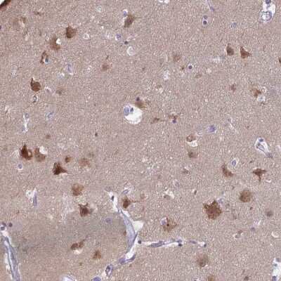 Immunohistochemistry-Paraffin: PLC-beta 1 Antibody [NBP2-37966]