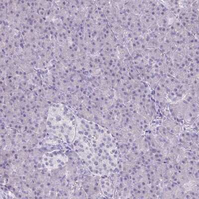 Immunohistochemistry-Paraffin: PLC-beta 1 Antibody [NBP2-37966]