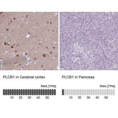 Immunohistochemistry-Paraffin: PLC-beta 1 Antibody [NBP2-37966]