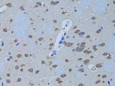 Immunohistochemistry-Paraffin: PLC-beta 1 Antibody - BSA Free [NBP2-93680]
