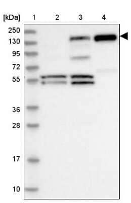 Western Blot: PLC-beta 1 Antibody [NBP2-38220]