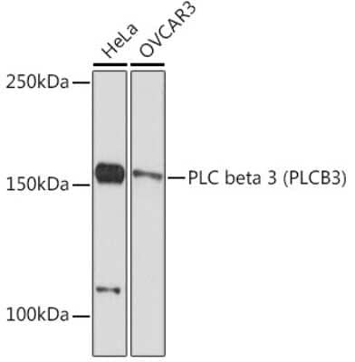 Western Blot: PLC-beta 3 Antibody (4C0Z7) [NBP3-15885]