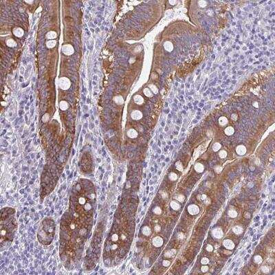 Immunohistochemistry: PLC-beta 3 Antibody [NBP2-31974]