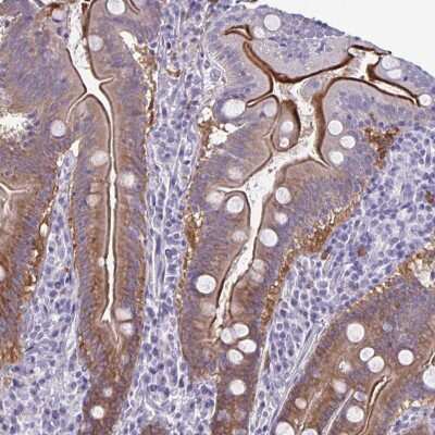 Immunohistochemistry: PLC-beta 3 Antibody [NBP2-32026]