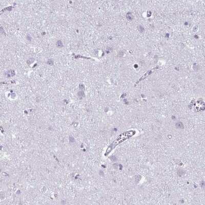 Immunohistochemistry-Paraffin: PLC-beta 3 Antibody [NBP2-31974]