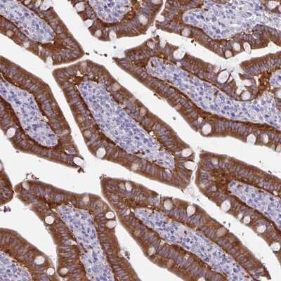 Immunohistochemistry-Paraffin: PLC-beta 3 Antibody [NBP2-31974]