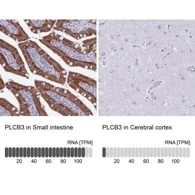 Immunohistochemistry-Paraffin: PLC-beta 3 Antibody [NBP2-31974]