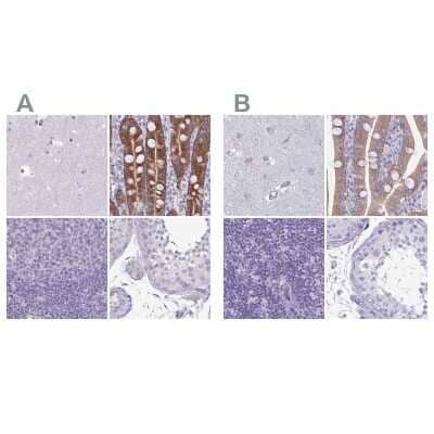 Immunohistochemistry-Paraffin: PLC-beta 3 Antibody [NBP2-31974]