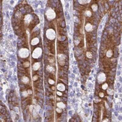 Immunohistochemistry-Paraffin: PLC-beta 3 Antibody [NBP2-31974]