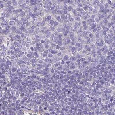 Immunohistochemistry-Paraffin: PLC-beta 3 Antibody [NBP2-31974]