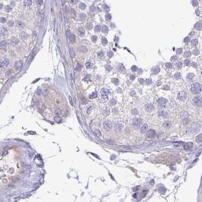 Immunohistochemistry-Paraffin: PLC-beta 3 Antibody [NBP2-31974]