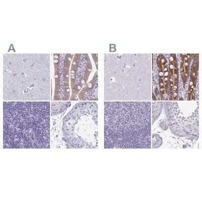 Immunohistochemistry-Paraffin: PLC-beta 3 Antibody [NBP2-32026]