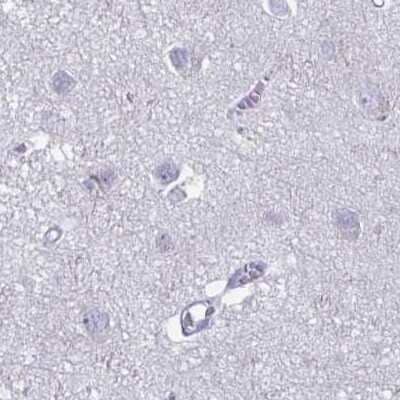 Immunohistochemistry-Paraffin: PLC-beta 3 Antibody [NBP2-32026]
