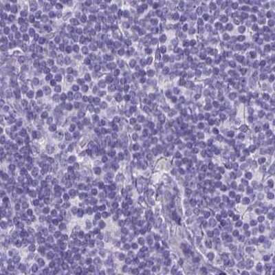 Immunohistochemistry-Paraffin: PLC-beta 3 Antibody [NBP2-32026]