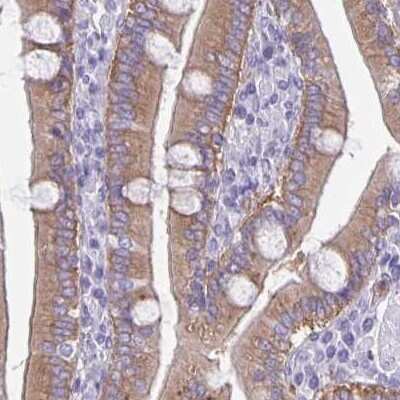Immunohistochemistry-Paraffin: PLC-beta 3 Antibody [NBP2-32026]