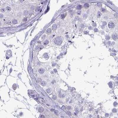 Immunohistochemistry-Paraffin: PLC-beta 3 Antibody [NBP2-32026]