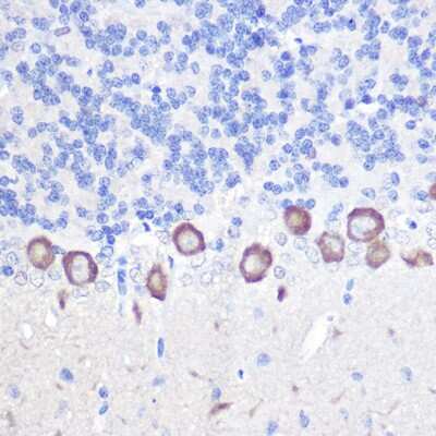 Immunohistochemistry-Paraffin: PLC-beta 3 Antibody - Azide and BSA Free [NBP2-93347]