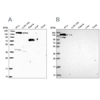 Western Blot: PLC-beta 3 Antibody [NBP2-31974]