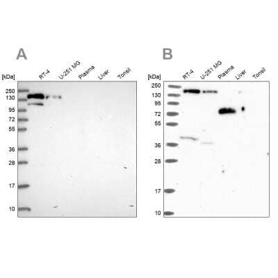 Western Blot: PLC-beta 3 Antibody [NBP2-32026]