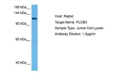 Western Blot: PLC-beta 3 Antibody [NBP2-88061]