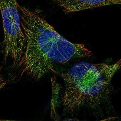 Immunocytochemistry/ Immunofluorescence: PLC-beta 4 Antibody [NBP2-58912]