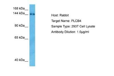 Western Blot: PLC-beta 4 Antibody [NBP2-85486]