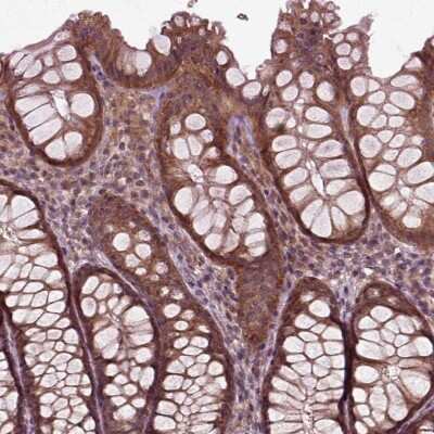 Immunohistochemistry-Paraffin: PLC-delta 3 Antibody [NBP2-68706]