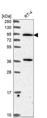 Western Blot: PLC-delta 3 Antibody [NBP2-68706]