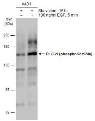 Western Blot: PLC-gamma 1 [p Ser1248] Antibody [NBP3-13242]