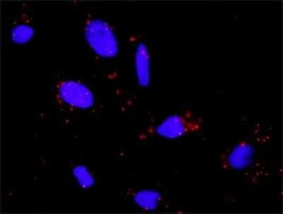 Proximity Ligation Assay: PLC-gamma 1 Antibody (2A2) [H00005335-M01]